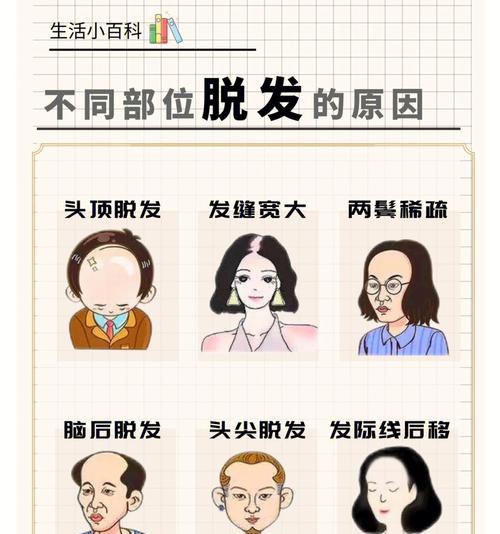 为什么掉头发很厉害怎么办（分享缓解头发掉发的6个小妙招）